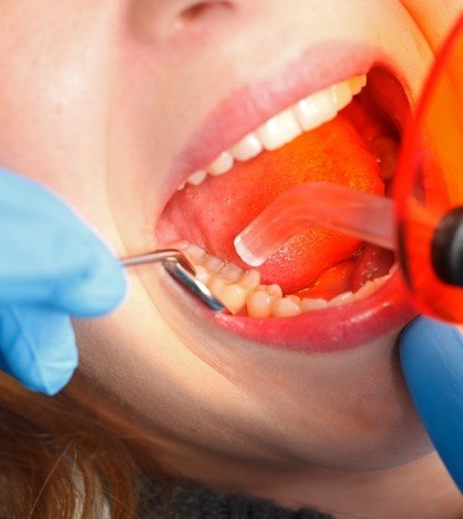 Close up of a patient getting dental bonding on their tooth