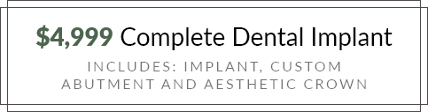 $4,999 Complete Dental Implant offer